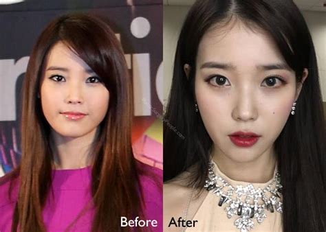 Do K-Pop Idols Get Plastic Surgery? A Detailed Analysis